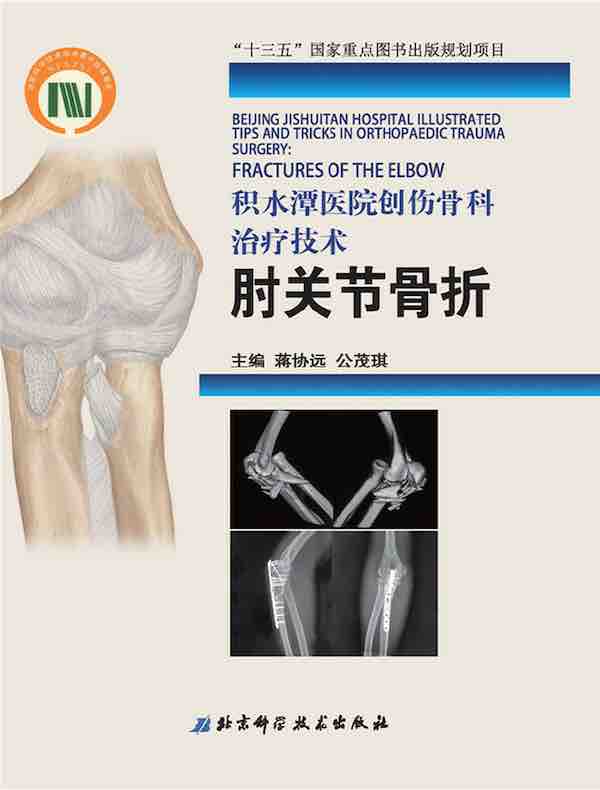 积水潭医院创伤骨科治疗技术：肘关节骨折