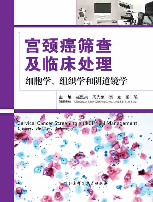 宫颈癌筛查及临床处理：细胞学、组织学和阴道镜学