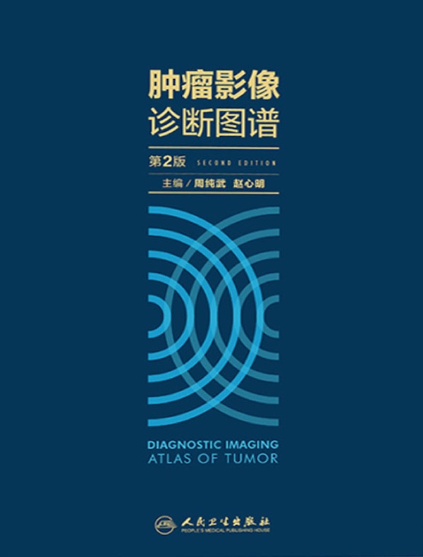 肿瘤影像诊断图谱（第2版）