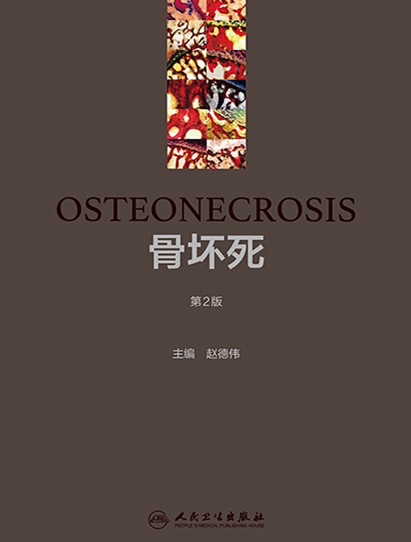 骨坏死（第2版）