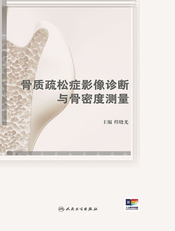 骨质疏松症影像诊断与骨密度测量