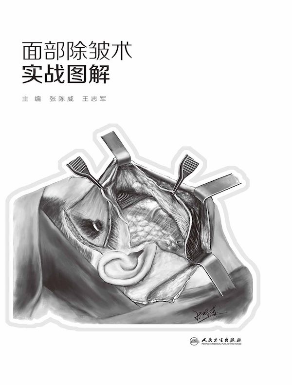 面部除皱术实战图解