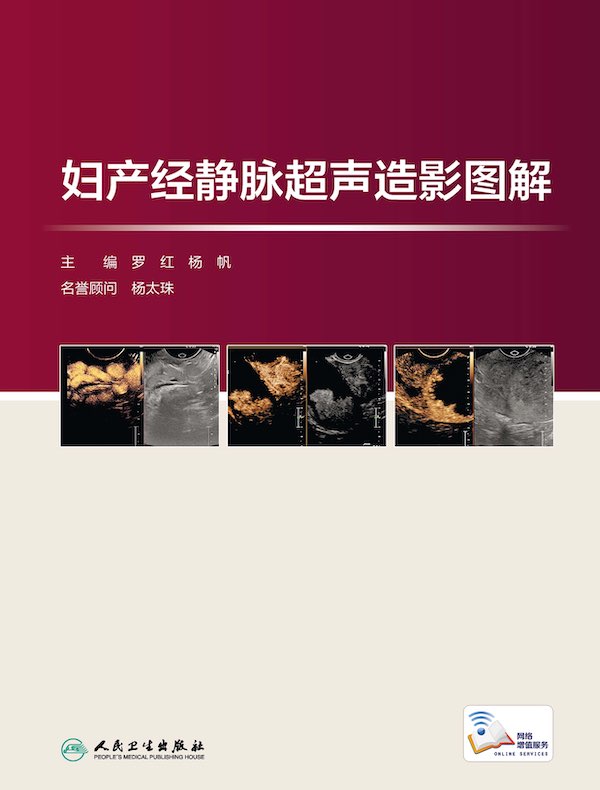 妇产经静脉超声造影图解