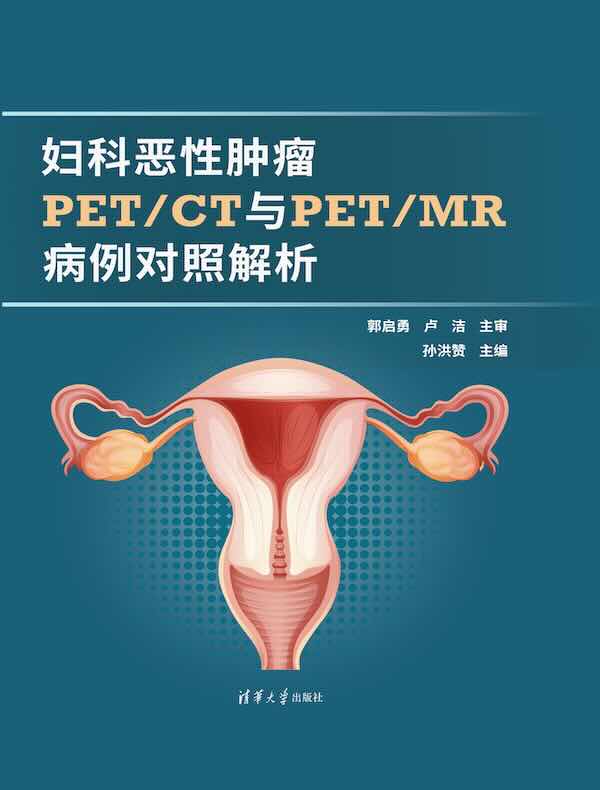 妇科恶性肿瘤PET/CT与PET/MR病例对照解析
